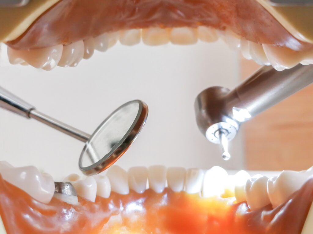 歯科医の治療